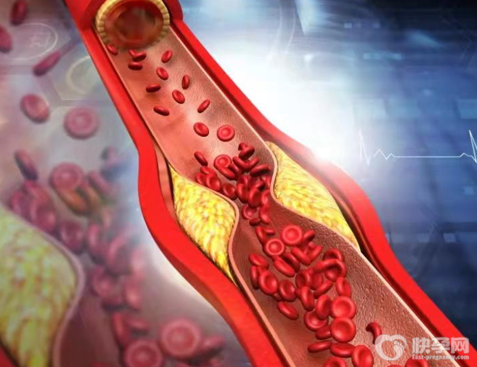 胆固醇高要如何调理？4个妙招降低胆固醇，稳控血脂