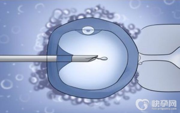 2025大理哪家医院可以做人工受孕，附试管医院排名榜！