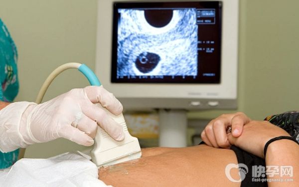 买了6年生育险做试管婴儿时能报销费用吗？