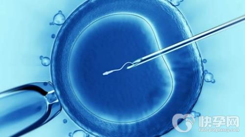 2023年在四川做试管婴儿有没有补助？要满足什么条件？