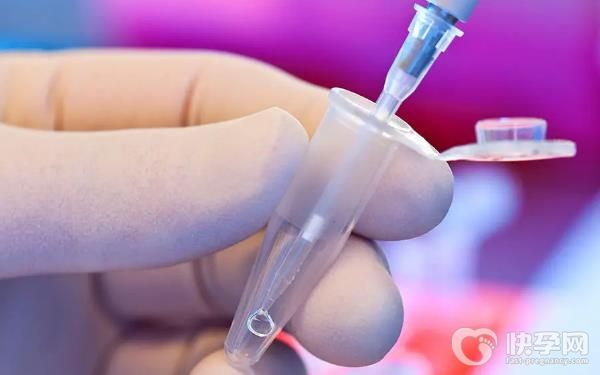 家恩德运赠卵试管收费要多少？真要不了30万