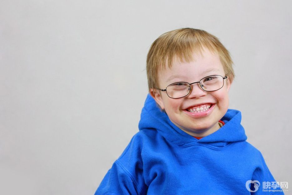 唐氏综合征患者有生育能力吗？这五大风险你不得不知！