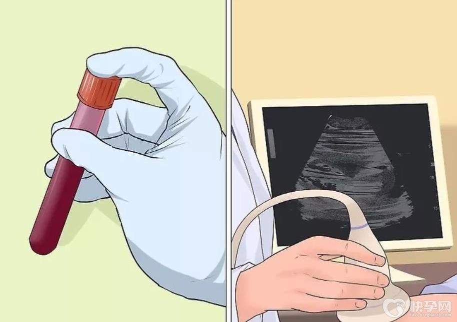 唐氏筛查临界风险胎儿会有问题吗？先别慌，听听专家怎么讲