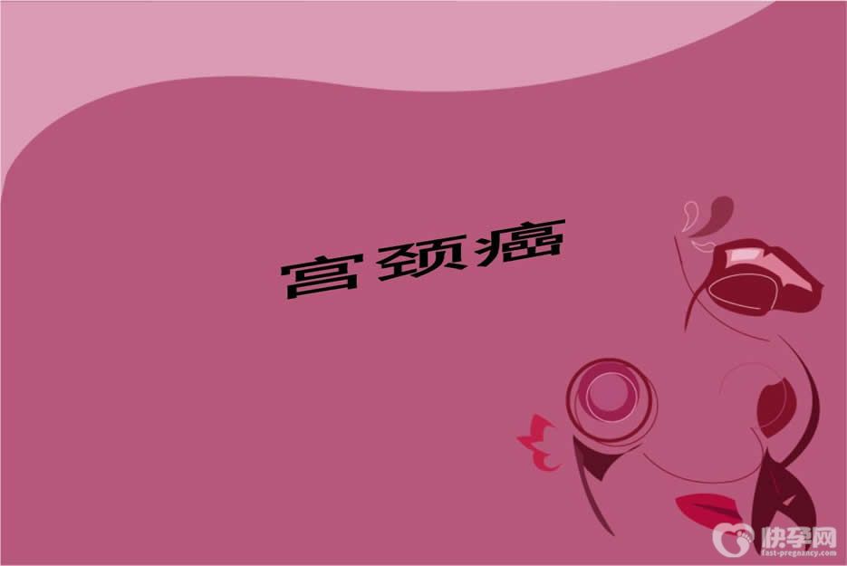 7种女人易患上宫颈癌，这份宫颈癌“高危名单”上有你吗？