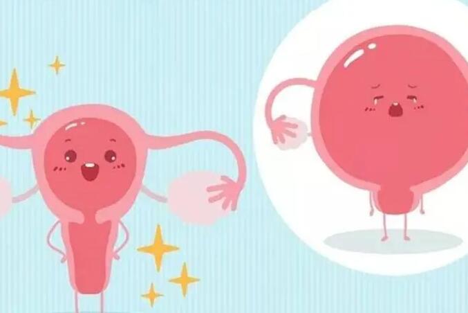 有没有子宫腺肌症试管成功的？腺肌症不能做试管吗？