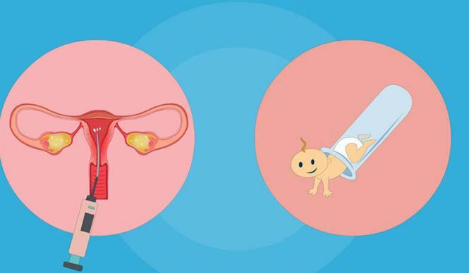 取3个卵泡做试管婴儿可以成功配型多少个胚胎？