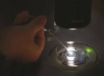 使用供卵做试管需要哪些检查？附检查详情？