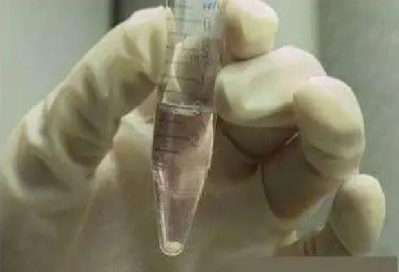 唐山妇幼做试管婴儿可以申请供精吗？唐山供精医院名单？