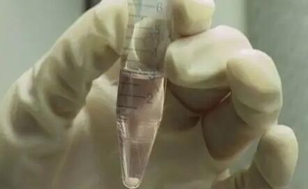 人工助孕能花多少钱？附全流程费用明细？