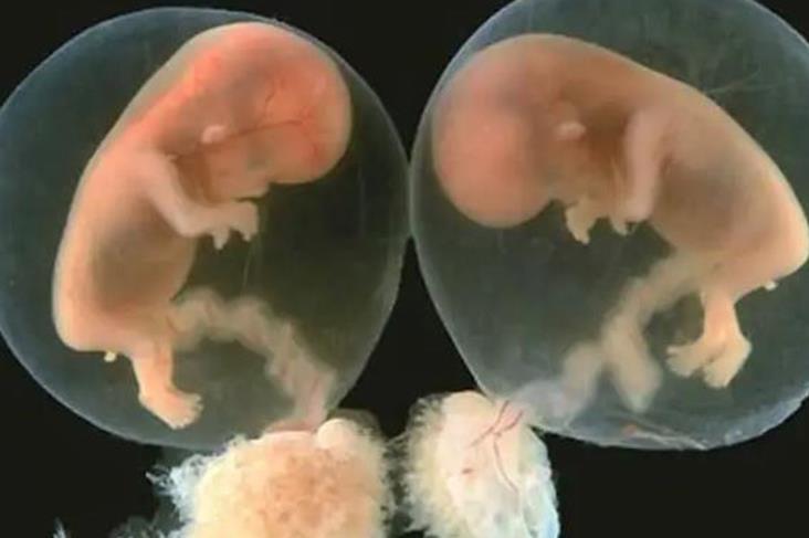 长沙市妇幼保健院试管婴儿龙凤胎成功率一览，附试管龙凤胎费用明细？