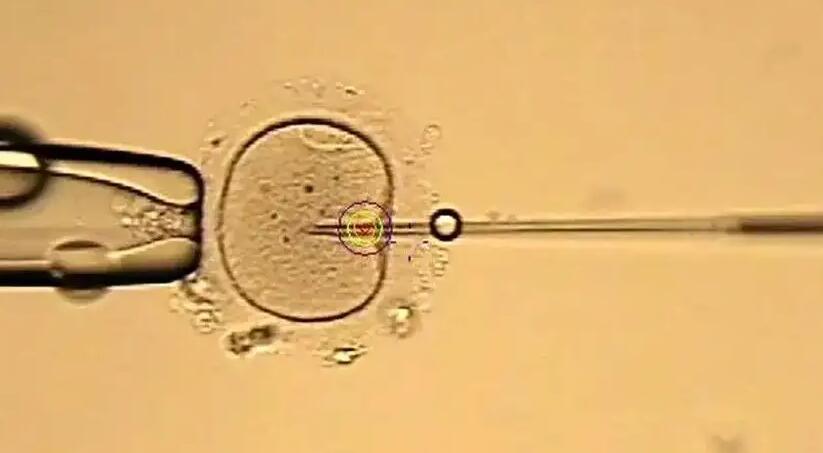 国内可以借卵生子吗？国内借卵生子多少钱？