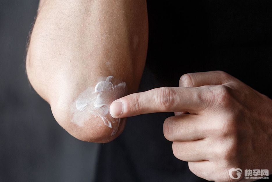 遗传性皮肤病做三代试管成功案例，移植后也不能掉以轻心