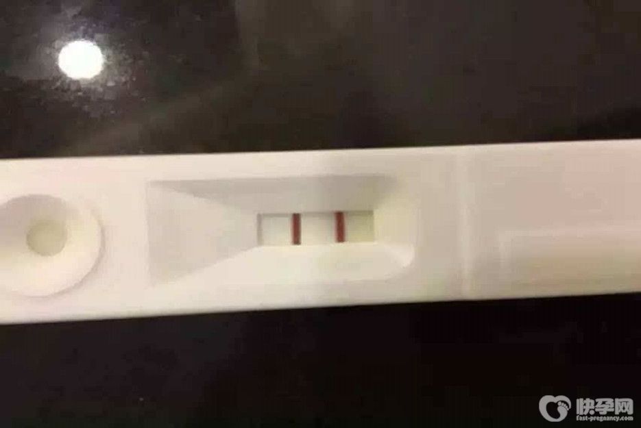 男方畸形精子原因二代试管成功案例-浮云难蔽日，雾散终有时