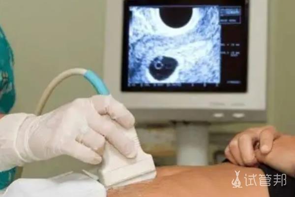 在海口玛丽医院第二代试管婴儿成功，分享移植前后的注意事项