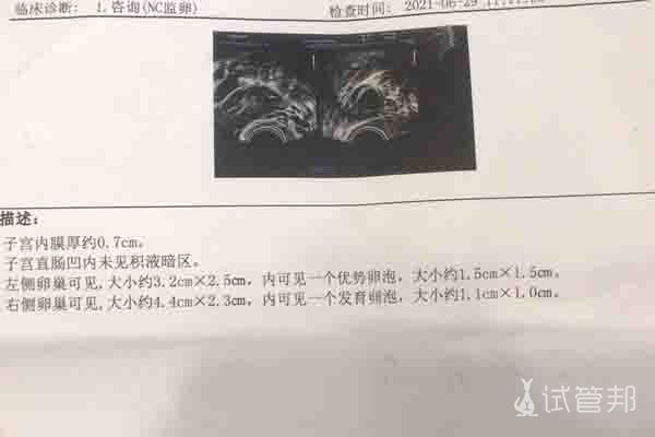 承德市中心医院试管婴儿进周了，希望等来好消息！