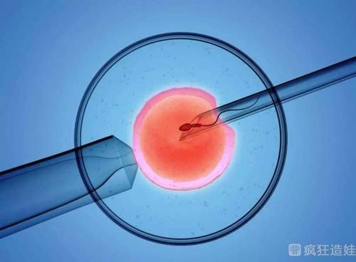 哪些男性不育症可以二代试管婴儿助孕？男性不育的六大问题值得收藏！