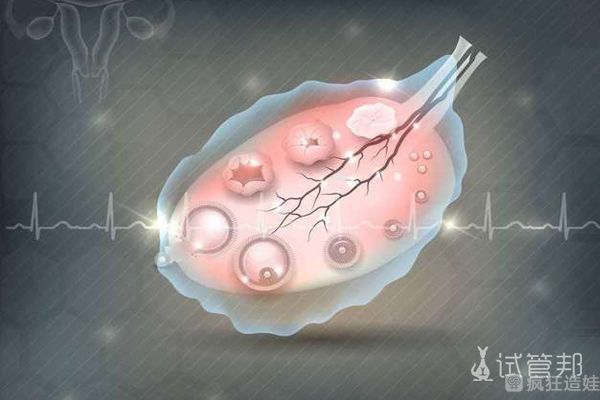 多年备孕无果，广东二代试管婴儿让家庭收获圆满