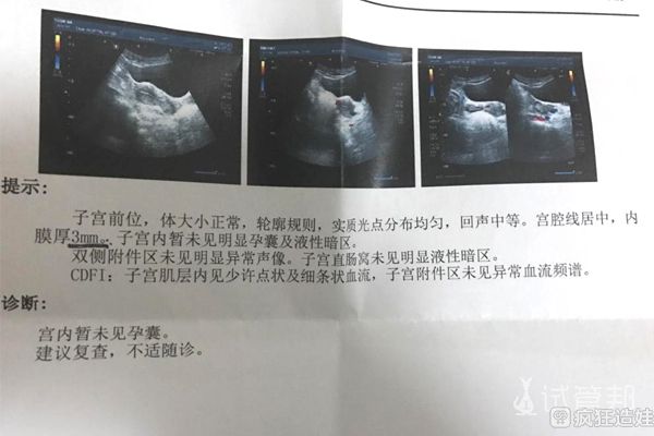 为了要二胎，做了3年二代试管婴儿，我要继续吗