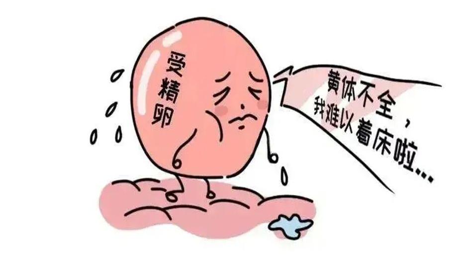 2022最新子宫内膜异位症试管促排方案选择攻略详情