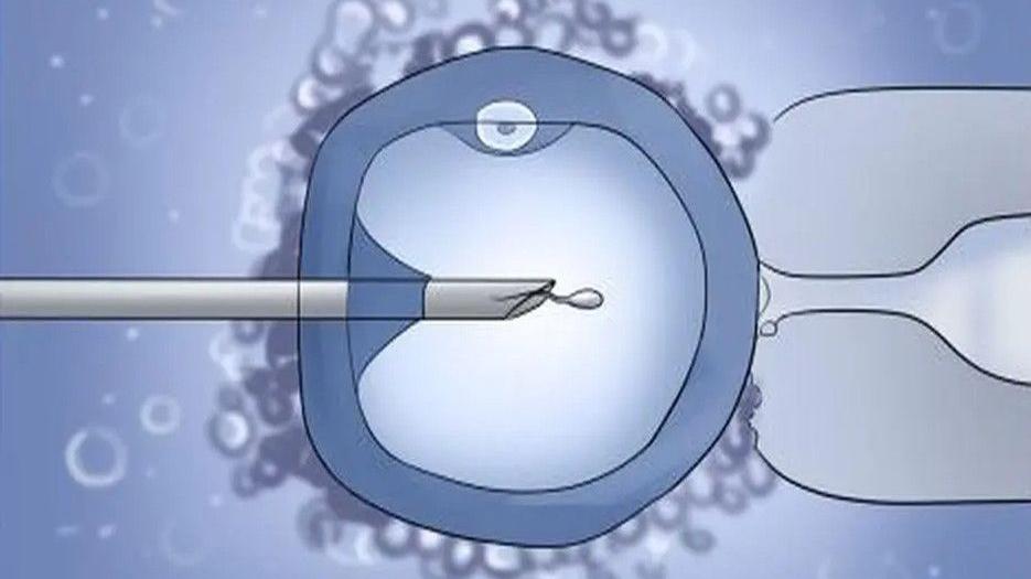 长春市妇产医院借卵做试管供卵多少钱？看完便知准备多少