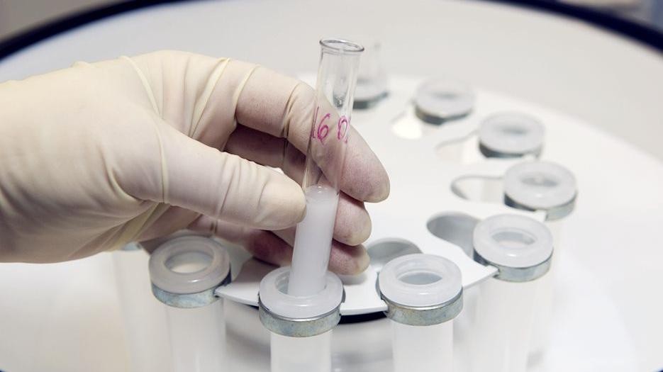 全面分析2022北京市海淀区妇幼保健院做三代试管供卵费用