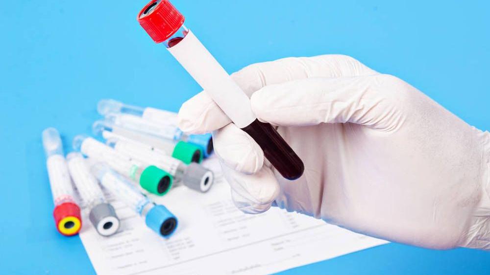 最新2023北京市海淀区妇幼保健院做三代试管生双胞胎费用看看吧