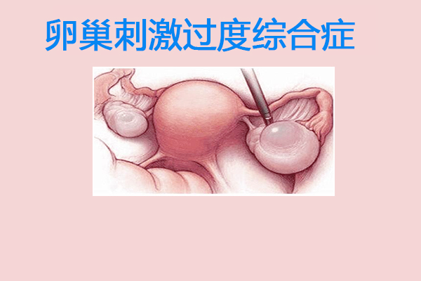 女人做了试管有后遗症吗？女人一定要小心这三个伤害！