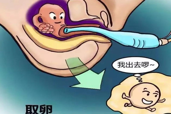 试管婴儿取卵后可以爬楼梯吗，当然是可以的