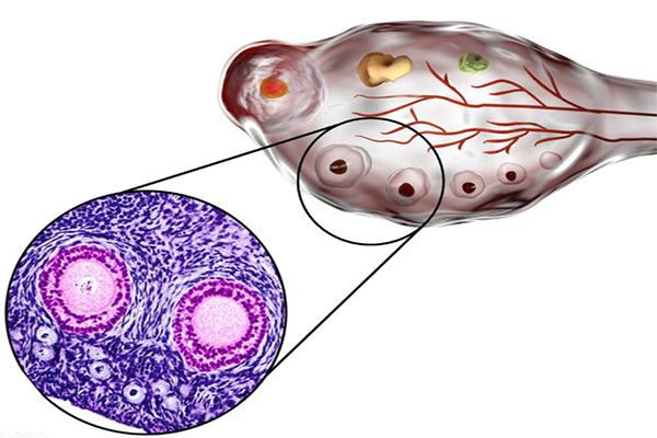 试管婴儿促排期间十大注意事项，做好了才能有利于卵泡发育！