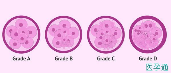试管婴儿如何选择优质胚胎？原来是胚胎有等级制度