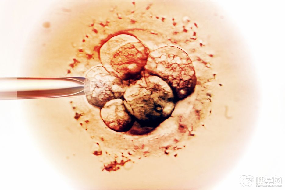 做试管婴儿取卵前准备-专家提示做试管婴儿取卵前需要注意什么