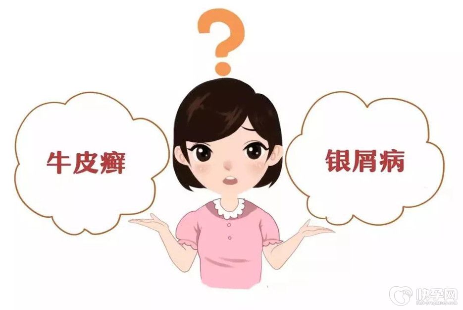 第三代试管能筛除银屑病吗？专家解答