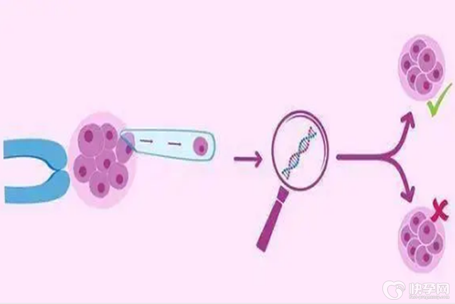 46岁做供卵试管成功后需在床上躺二个月吗-一般是不需要的