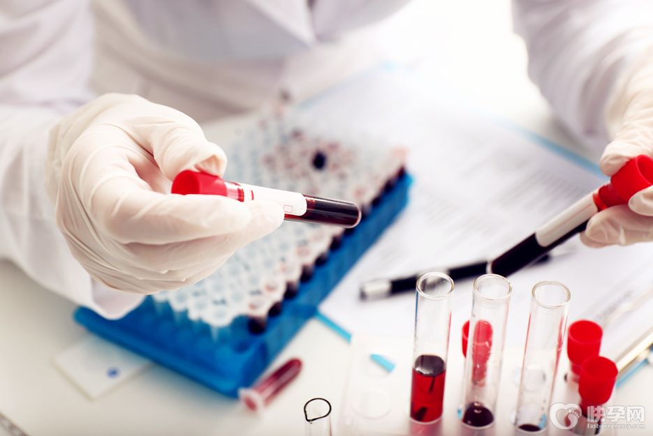 上海做试管婴儿前做哪些检查？专家最全面解读做试管婴儿要做哪些检查