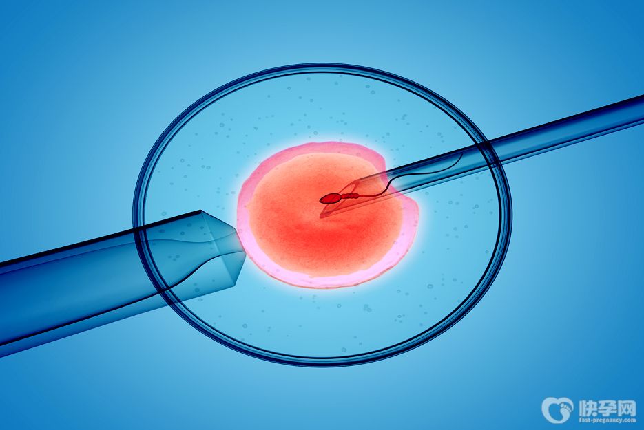 精子有细菌能做试管婴儿吗？专家解读试管婴儿精子有细菌影响怀孕吗