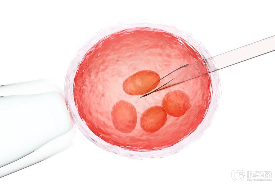 2年内莫名其妙地流产3次-建议不要再坚持自怀趁早做试管婴儿