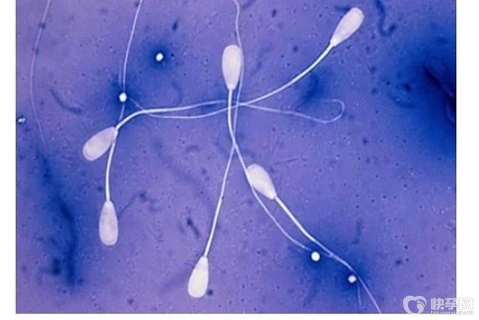 少精症能做试管吗？方式不对，努力白费