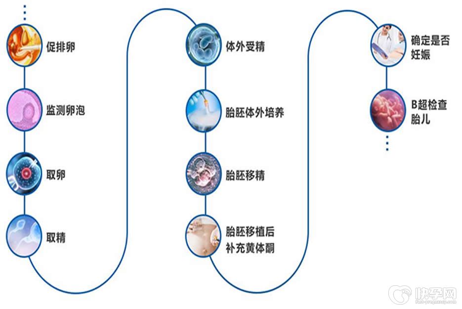 试管婴儿没有想象中疼吗？用事实说话
