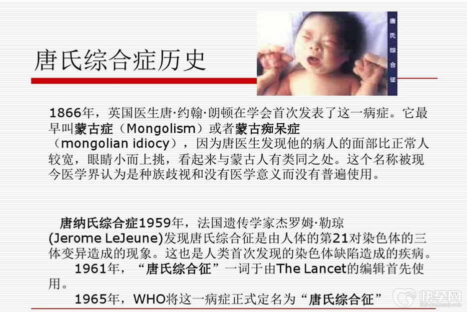 唐氏综合征患者可以生育吗？ 逆风而行未必可行