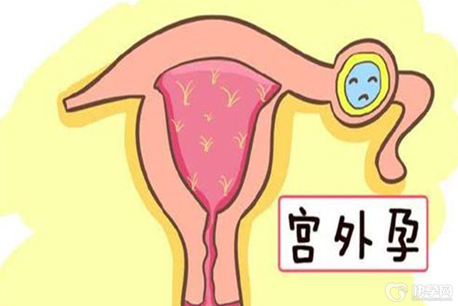 试管婴儿也会宫外孕？医生道出实情，别不信