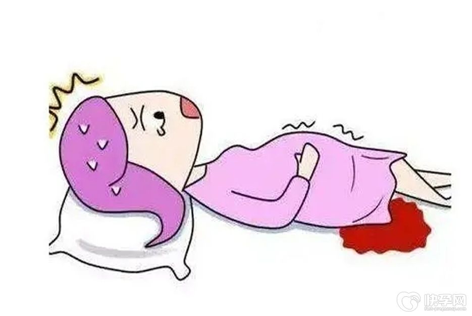 二代试管婴儿孕中期出血是怎么会事儿？看完你就彻底明白了