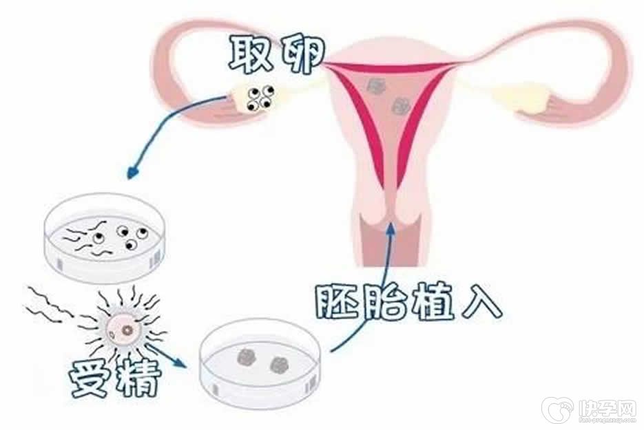 什么样的情况下才能做试管？这九种情况助你一眼识别