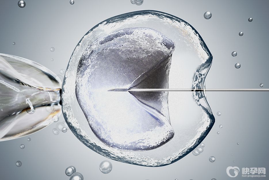 试管婴儿的弊端与好处大揭秘，不管好坏我都实话实说