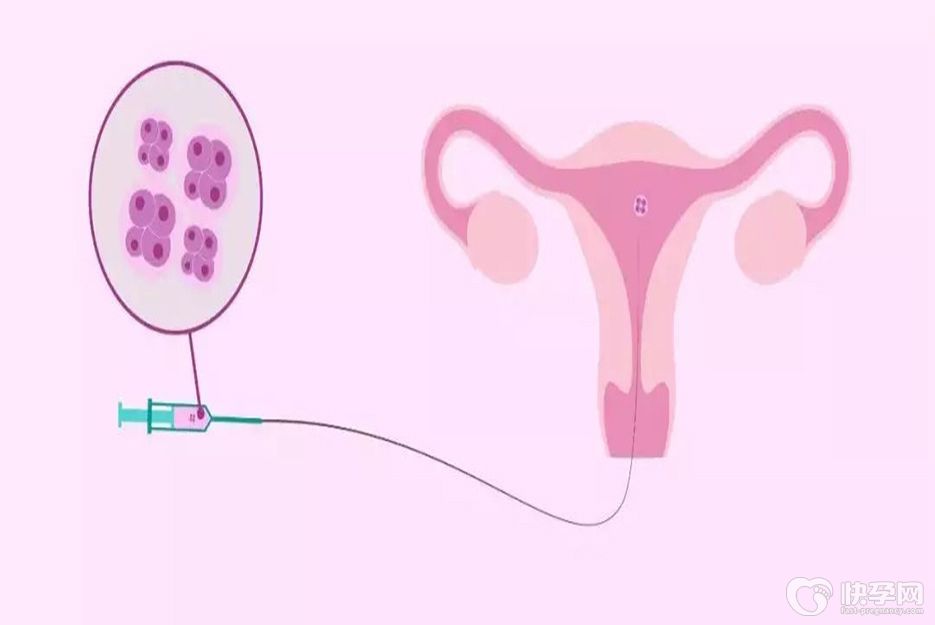 科普试管婴儿反复移植失败的因素，想有好“孕”最好看看