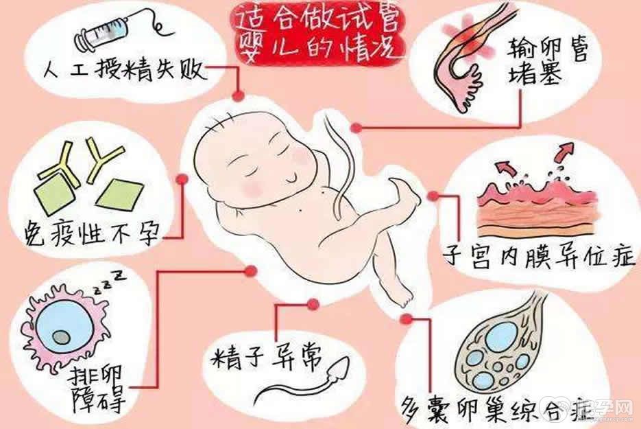 夫妻在什么情况下可以做试管婴儿？盘点 这十三种情况内可以大胆选择