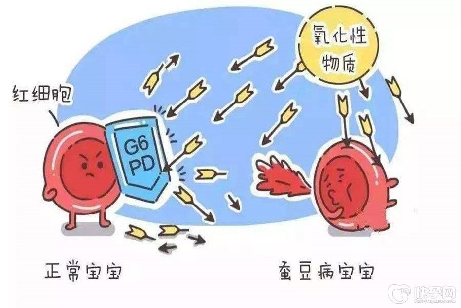 女方有蚕豆病可以做试管吗-第三代试管是“救星”