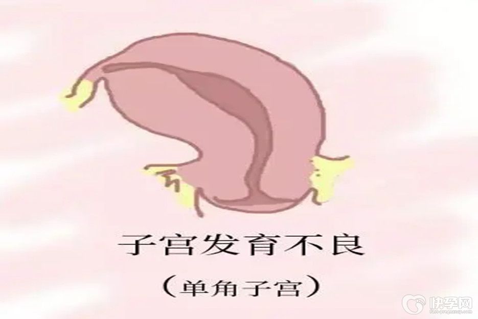 单角子宫还有怀孕的机会，但对胎儿有这些危害需谨慎