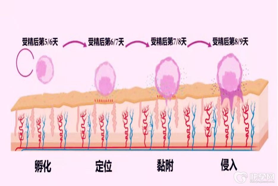 试管婴儿移植怎么知道着没着床？分享着床初期7个细微的表现