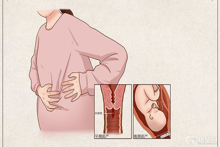 纵隔子宫术后试管移植不着床？多半是这5个原因，别不当回事