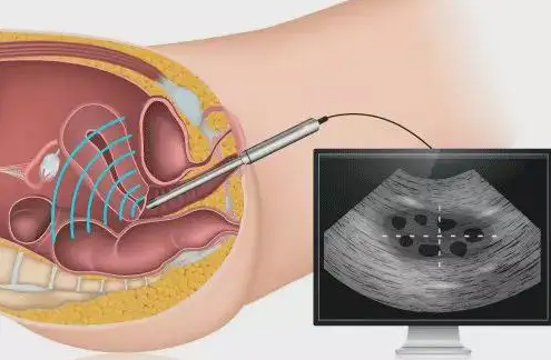人工授精子女，法律上视同婚生子女？